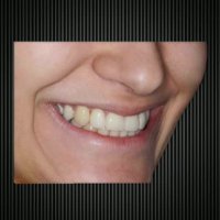 ارتودنسی غرب تهران | دکتر داوودیان