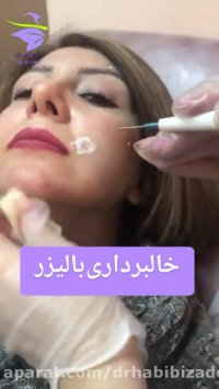 خالبرداری با لیزر