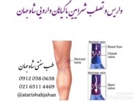 مشاوره تلفنی با متخصص طب سنتی 09120580638