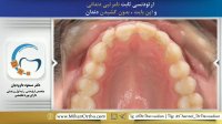 دکتر ارتودنسی | دکتر داوودیان