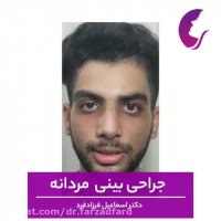 جراحی بینی مردانه