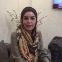 فیلم کاشت ابرو - کلینیک تخصصی رنسانس