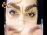 کاشت ابرو طبیعی با روش SUT مرکز کاشت مو