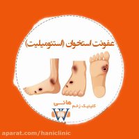 عفونت استخوان