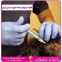 تقویت و رویش مجدد موی سر با پی آر پی