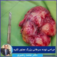 فیلم جراحی توده سرطانی بزرگ مجاور کلیه دکتر محمد رنجبری