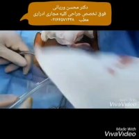 فیلم عمل جراحی بیضه