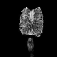 تصویر آناناس در دستگاه "MRI"