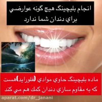 اهمیت بلیچینگ دندان
