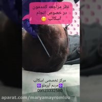 نظر مراجعه کنندمون در مورد اسکالپ سر