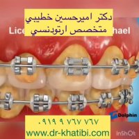 عوارض عدم رعایت بهداشت در ارتودنسی