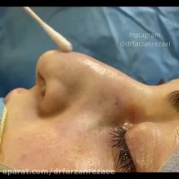 فیلم بدون سانسور جراحی بینی نیمه فانتزی