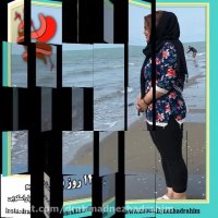 32 کیلوگرم کاهش وزن 140 روز بعر از بای پس کلاسیک