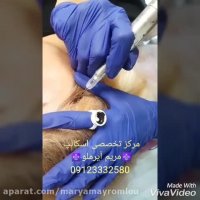 درمان قطعی ریزش مو در خانم ها