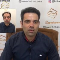 کاشت مو | کلینیک تخصصی رنسانس  02122088210