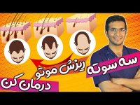 درمان ریزش مو