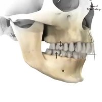 انیمیشن اصلاح ناهنجاری فكی و دندانی