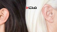 چرا موهای شما سفید می شوند