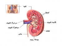 علل فشار خون با منشا کلیوی