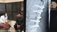 فیلم واقعی جراحی شکستگی مهره و بهبودی فلج پاها