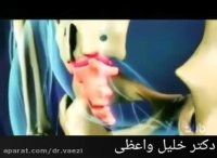 کسانی که مشکل درد در ناحیه دنبالچه دارند حتما ببینند