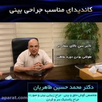 کاندیدای مناسب جراحی بینی