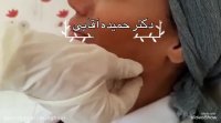 فیلم زاویه سازی فک با تزریق ژل