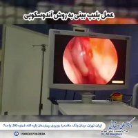 فیلم عمل پلیپ بینی