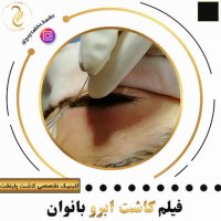 کاشت ابرو طبیعی | کلینیک پایتخت | 44228594-021