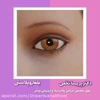 انیمیشن کوتاه جراحی بلفاروپلاستی