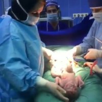 فیلم واقعی از لحظه تولد دوقلوها