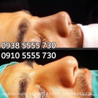 قبل و بعد عمل بینی