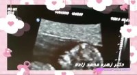 ویدئو جنین ۱۲ هفته ای