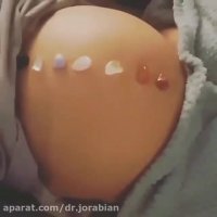 حرکات عجیب جنین