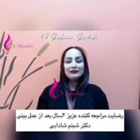 فیلم نتیجه عمل جراحی بینی بعد از 3 سال