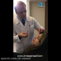 تزریق بوتاکس پیشانی توسط دکتر مسعود ناصری صدر