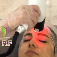 جوانسازی با لیزر آر اف معجزه زیبایی