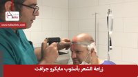 زراعه الشعر بطریقه مایکرو جرافت | عیاده هلیا | 00989120234708