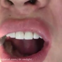 بررسی دندان