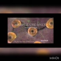 درمان تخمدان پلی کیستیک برای بارداری