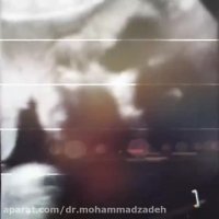 جنین زیبای ۳۱ هفته