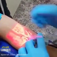 شیوه پیدا کردن رگ در آمریکا رو ببینید