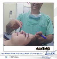 فیلم جراحی بینی گوشتی