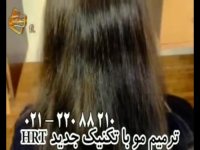 ترمیم مو به روش HRT  مرکز تخصصی مو رنسانس