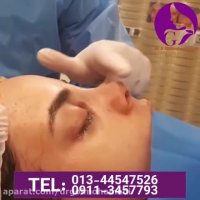 فیلم عمل زیبایی بینی