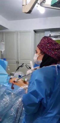 لایو اینستاگرام : اسلیو گاسترکتومی در خانم 32 ساله