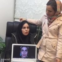 نمونه جراحی زیبایی بینی