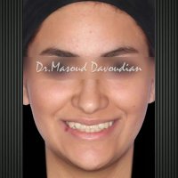 دکتر ارتودنسی | دکتر داوودیان