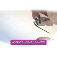 اصلاح کراس بایت با الاستیک