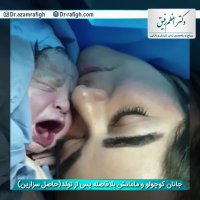 فیلم زایمان سزارین